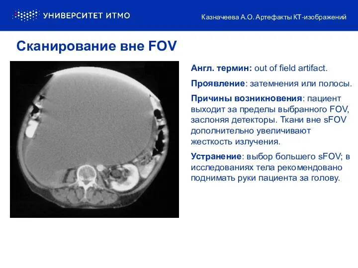 Англ. термин: out of field artifact. Проявление: затемнения или полосы.