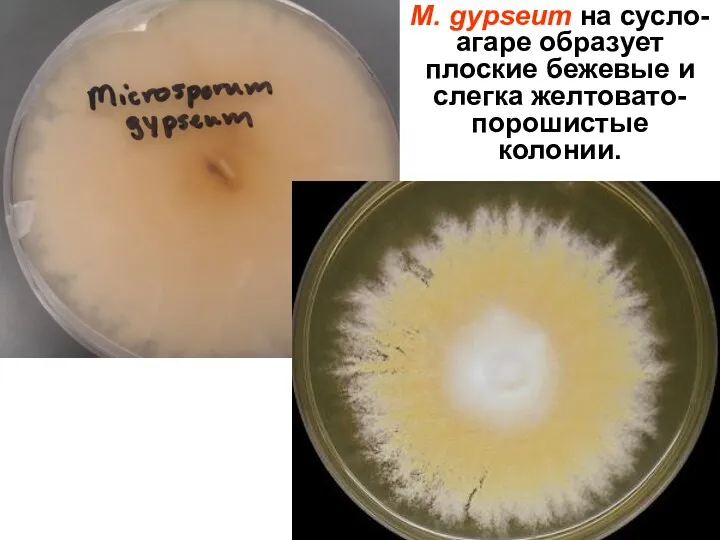 M. gypseum на сусло-агаре образует плоские бежевые и слегка желтовато-порошистые колонии.