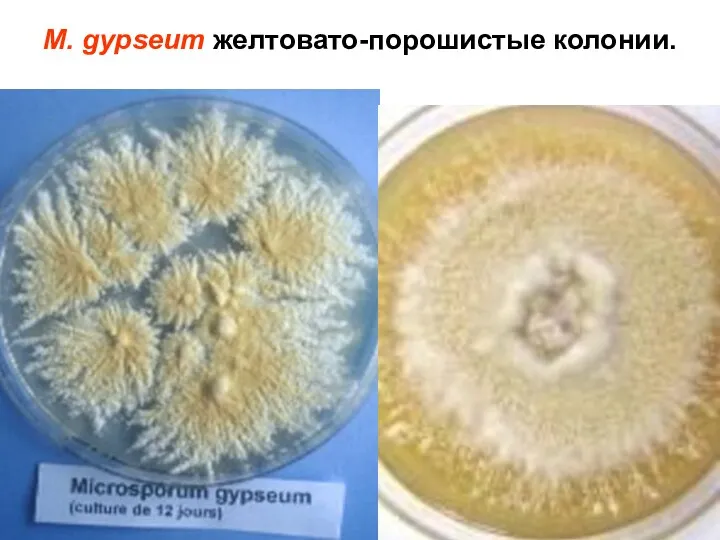 M. gypseum желтовато-порошистые колонии.