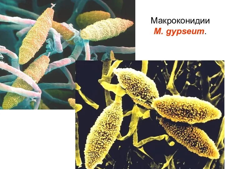 Макроконидии M. gypseum.