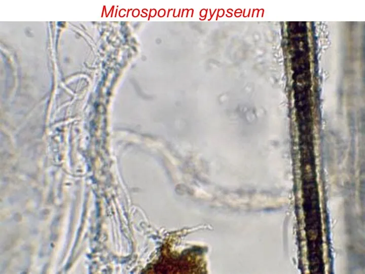 Microsporum gypseum