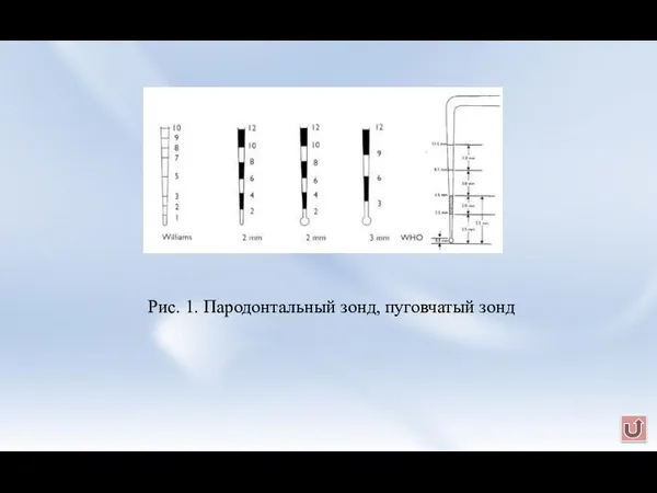 Рис. 1. Пародонтальный зонд, пуговчатый зонд