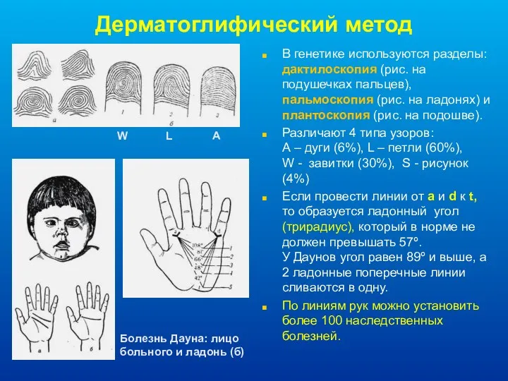 Дерматоглифический метод В генетике используются разделы: дактилоскопия (рис. на подушечках