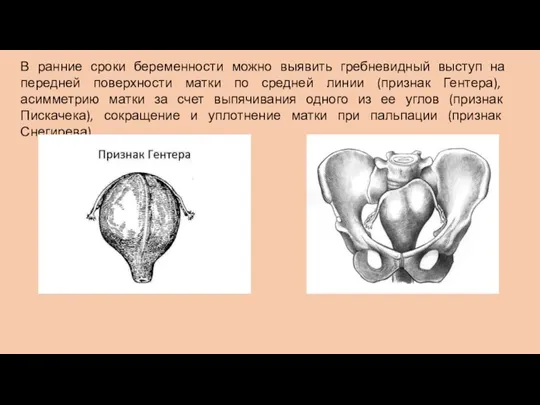 В ранние сроки беременности можно выявить гребневидный выступ на передней