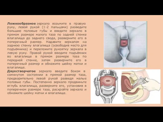 Ложкообразное зеркало возьмите в правую руку, левой рукой (1-2 пальцами)