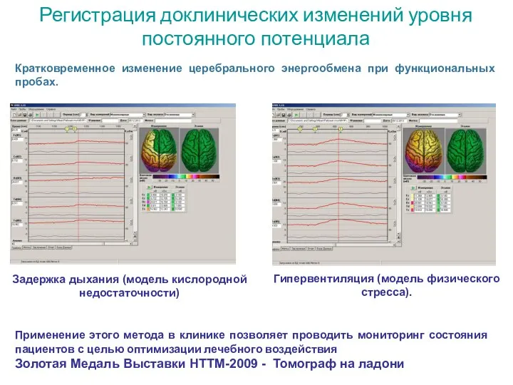 Регистрация доклинических изменений уровня постоянного потенциала Применение этого метода в