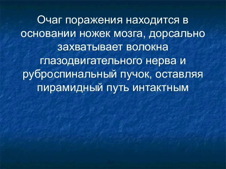 Очаг поражения находится в основании ножек мозга, дорсально захватывает волокна