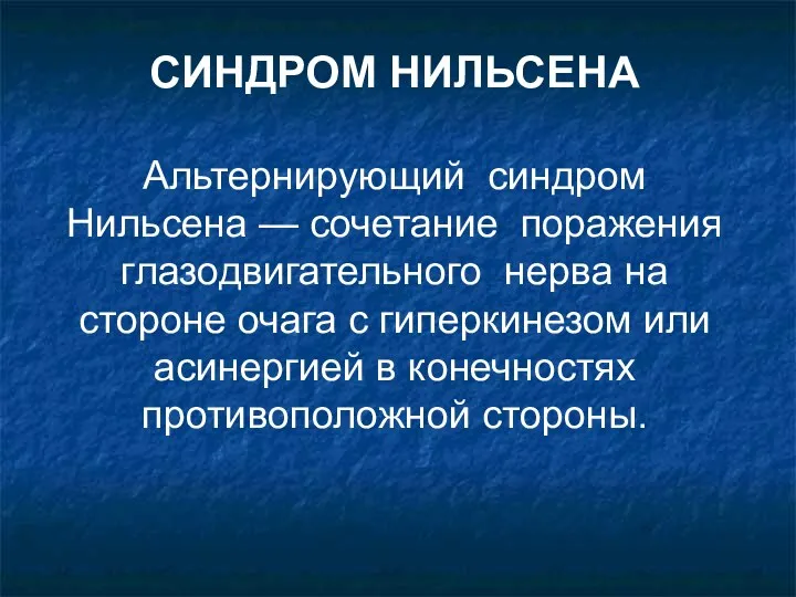 СИНДРОМ НИЛЬСЕНА Альтернирующий синдром Нильсена — сочетание поражения глазодвигательного нерва