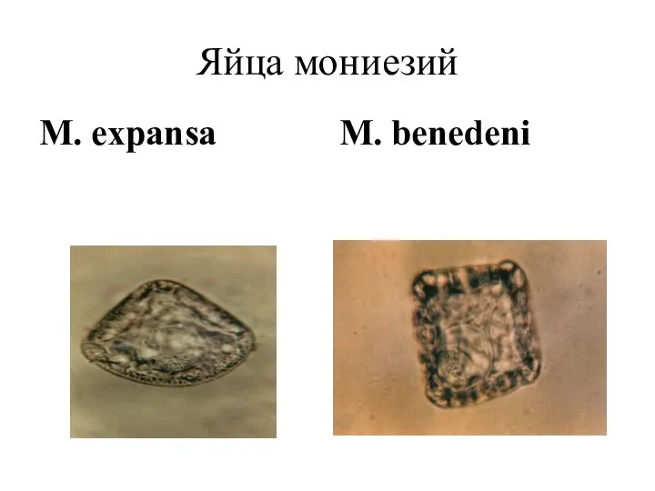 Яйца мониезий М. expansa М. benedeni
