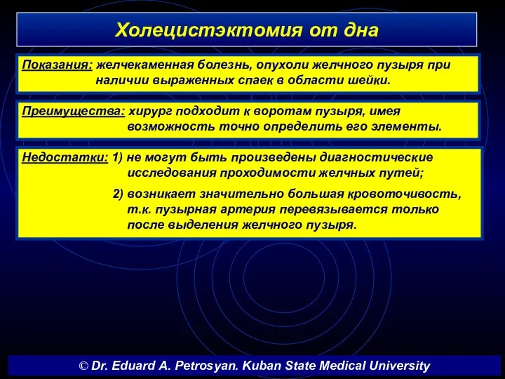 Холецистэктомия от дна 10 Показания: желчекаменная болезнь, опухоли желчного пузыря