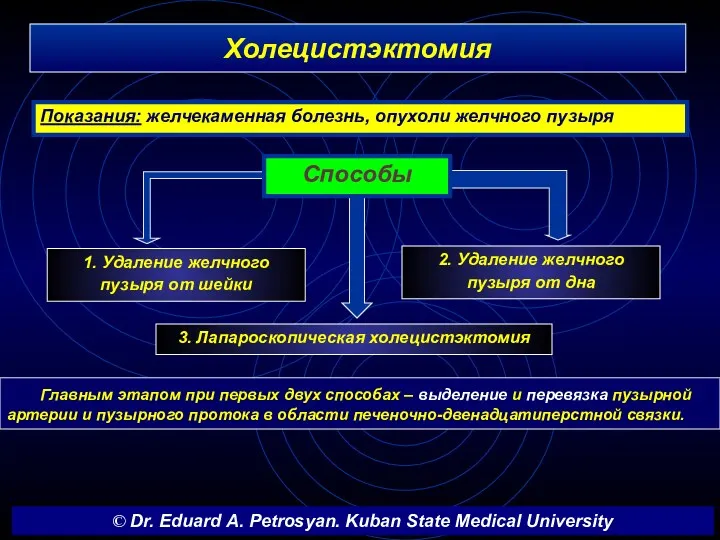 Холецистэктомия Главным этапом при первых двух способах – выделение и