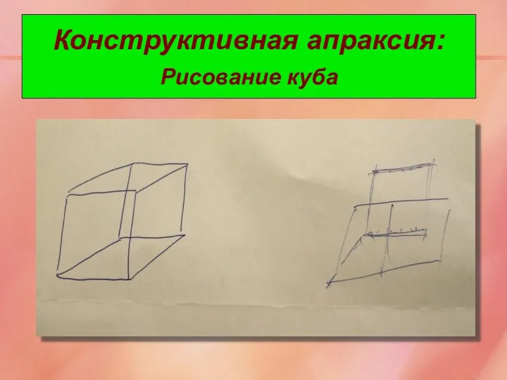 Конструктивная апраксия: Рисование куба