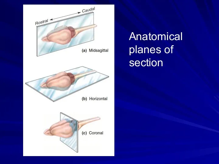 Anatomical planes of section