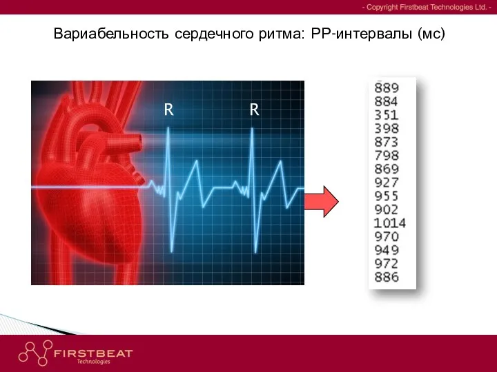 Вариабельность сердечного ритма: РР-интервалы (мс) - Copyright Firstbeat Technologies Ltd. - R R