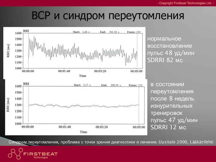 нормальное восстановление пульс 48 уд/мин SDRRI 82 мс в состоянии