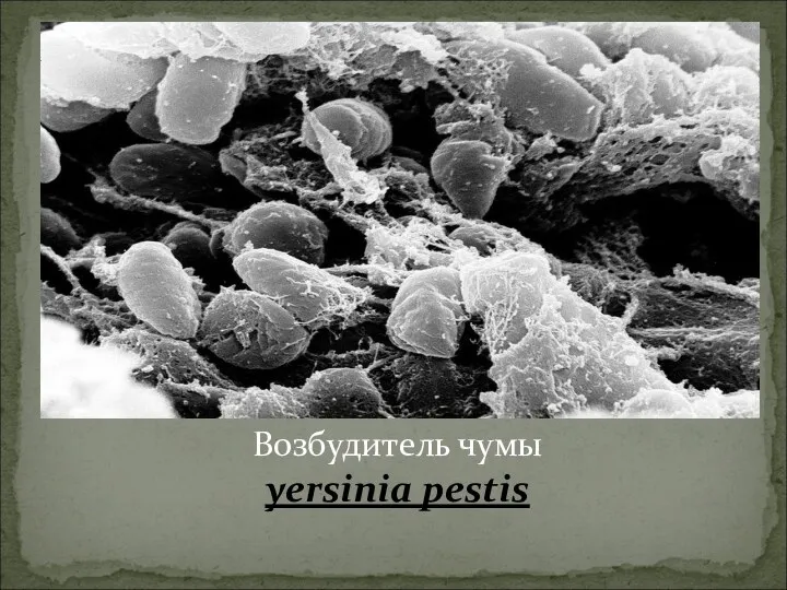 Возбудитель чумы yersinia pestis