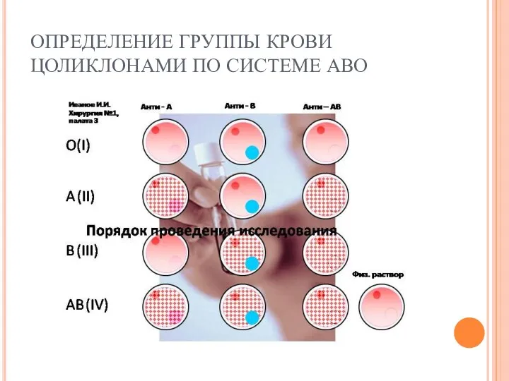 ОПРЕДЕЛЕНИЕ ГРУППЫ КРОВИ ЦОЛИКЛОНАМИ ПО СИСТЕМЕ АВО