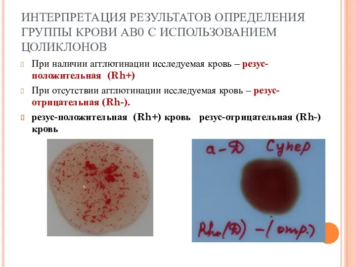 Косимова О.И. ИНТЕРПРЕТАЦИЯ РЕЗУЛЬТАТОВ ОПРЕДЕЛЕНИЯ ГРУППЫ КРОВИ АВ0 С ИСПОЛЬЗОВАНИЕМ