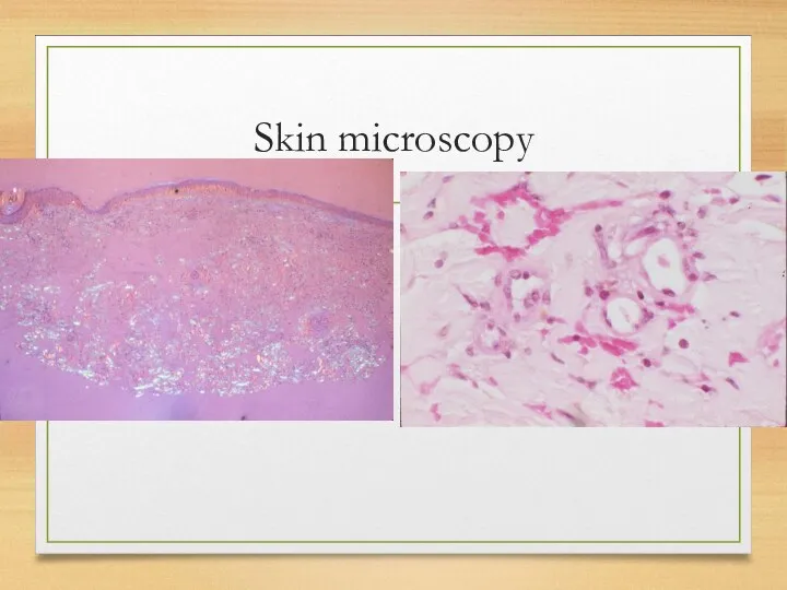 Skin microscopy