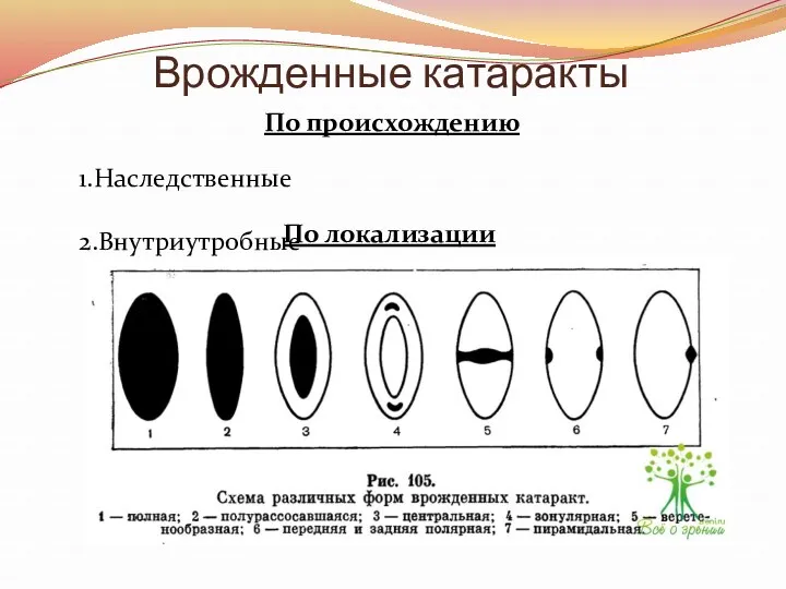 Врожденные катаракты 1.Наследственные 2.Внутриутробные По происхождению По локализации