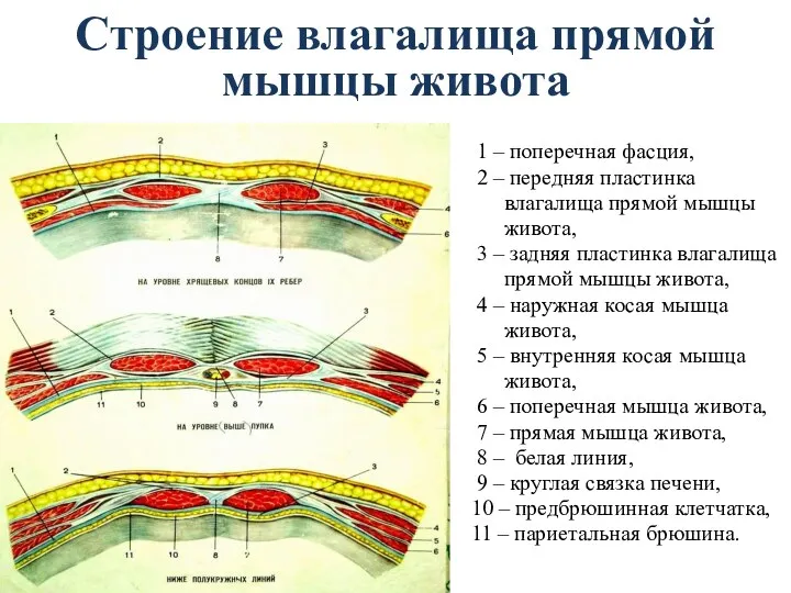 Строение влагалища прямой мышцы живота 1 – поперечная фасция, 2