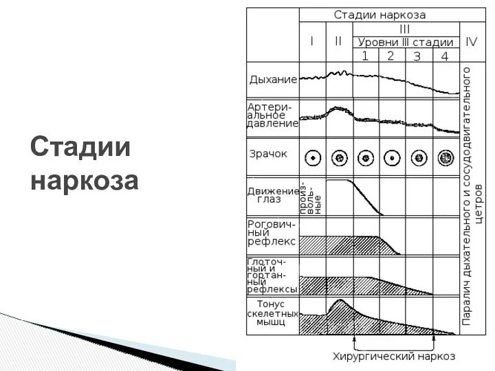 Стадии наркоза