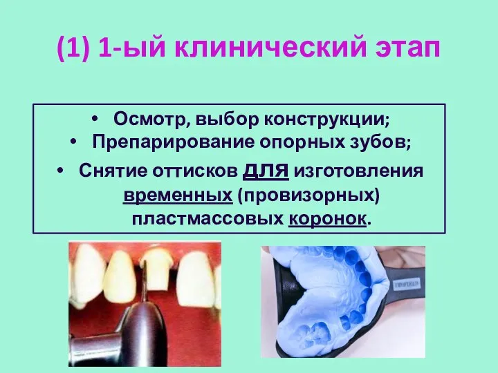 (1) 1-ый клинический этап Осмотр, выбор конструкции; Препарирование опорных зубов;