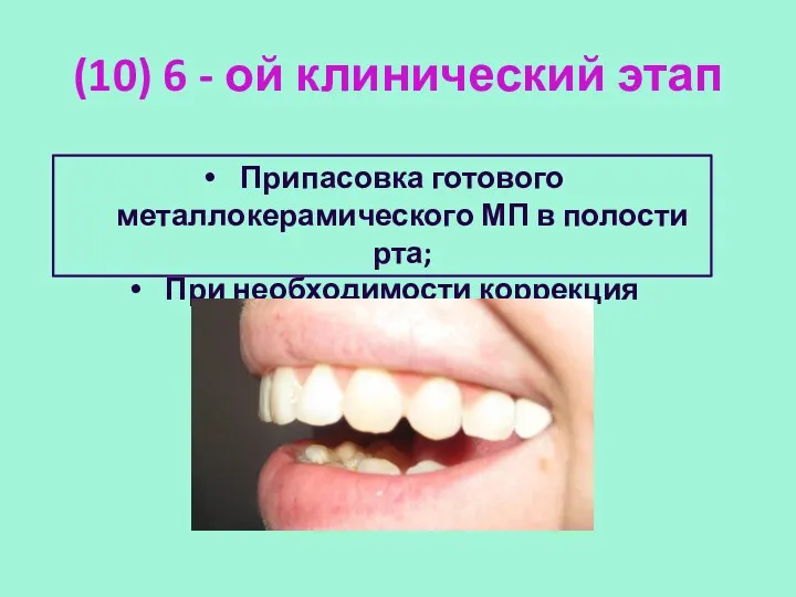 (10) 6 - ой клинический этап Припасовка готового металлокерамического МП в полости рта; При необходимости коррекция