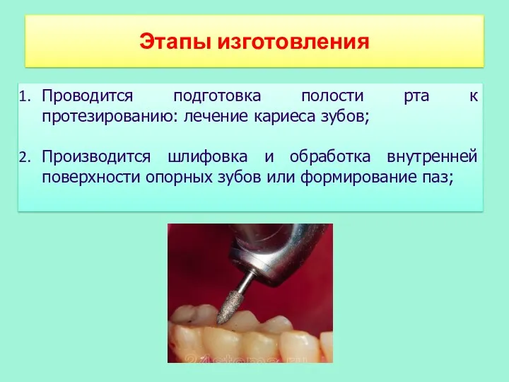 Этапы изготовления Проводится подготовка полости рта к протезированию: лечение кариеса