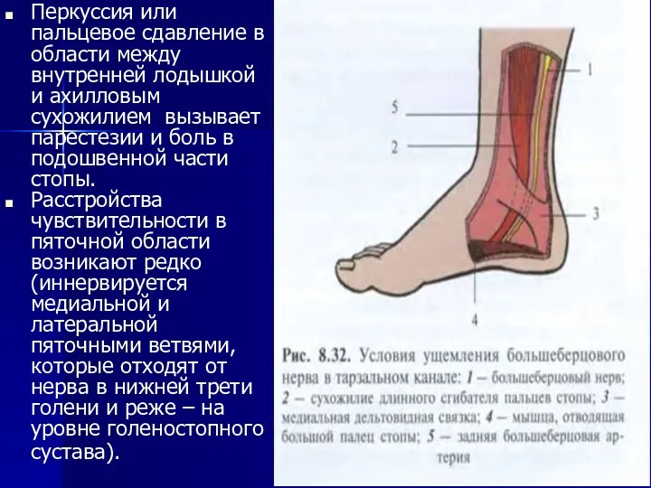 Перкуссия или пальцевое сдавление в области между внутренней лодышкой и ахилловым сухожилием вызывает