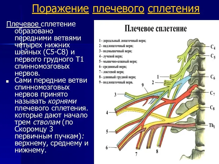 Поражение плечевого сплетения Плечевое сплетение образовано передними ветвями четырех нижних шейных (С5-С8) и