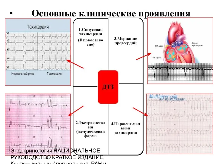 Основные клинические проявления Эндокринология.НАЦИОНАЛЬНОЕ РУКОВОДСТВО КРАТКОЕ ИЗДАНИЕ. Краткое издание/ под.ред