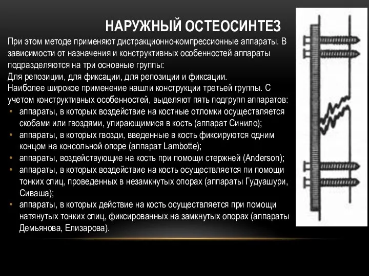 НАРУЖНЫЙ ОСТЕОСИНТЕЗ При этом методе применяют дистракционно-компрессионные аппараты. В зависимости