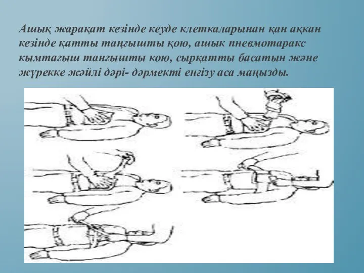 Ашық жарақат кезінде кеуде клеткаларынан қан ақкан кезінде қатты таңғышты