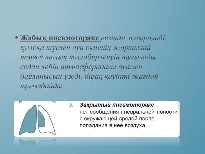 Жабық пневмоторакс кезінде плевральді қуысқа түскен ауа өкпенің жартылай немесе