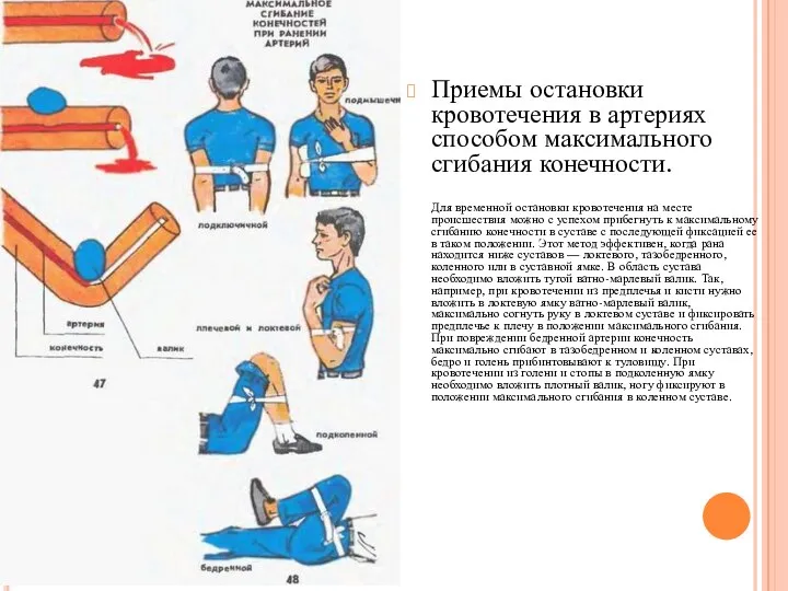 Приемы остановки кровотечения в артериях способом максимального сгибания конечности. Для