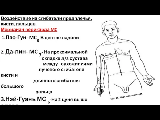 Воздействие на сгибатели предплечья, кисти, пальцев Меридиан перикарда MC 1.Лао-Гун- MC8 В центре