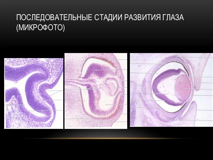 ПОСЛЕДОВАТЕЛЬНЫЕ СТАДИИ РАЗВИТИЯ ГЛАЗА (МИКРОФОТО)