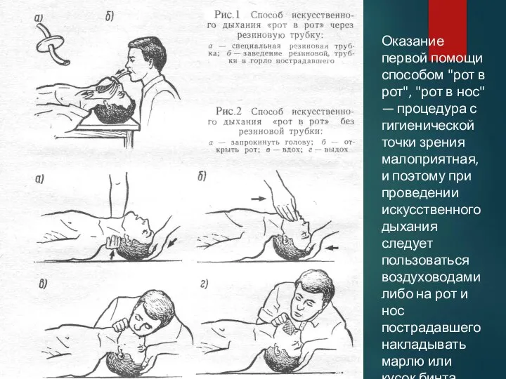 Оказание первой помощи способом "рот в рот", "рот в нос"