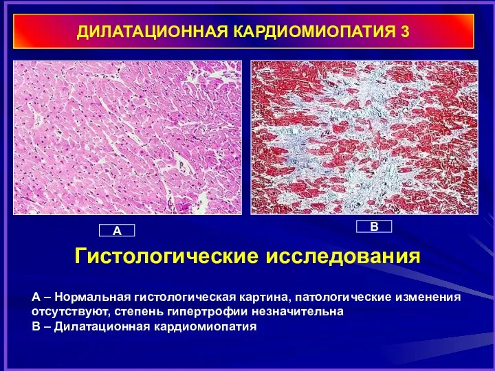 Гистологические исследования A – Нормальная гистологическая картина, патологические изменения отсутствуют,