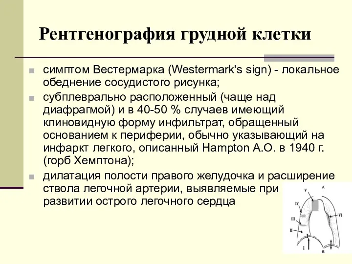 Рентгенография грудной клетки симптом Вестермарка (Westermark's sign) - локальное обеднение сосудистого рисунка; субплеврально