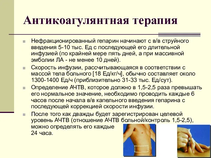 Антикоагулянтная терапия Нефракционированный гепарин начинают с в/в струйного введения 5-10 тыс. Ед с