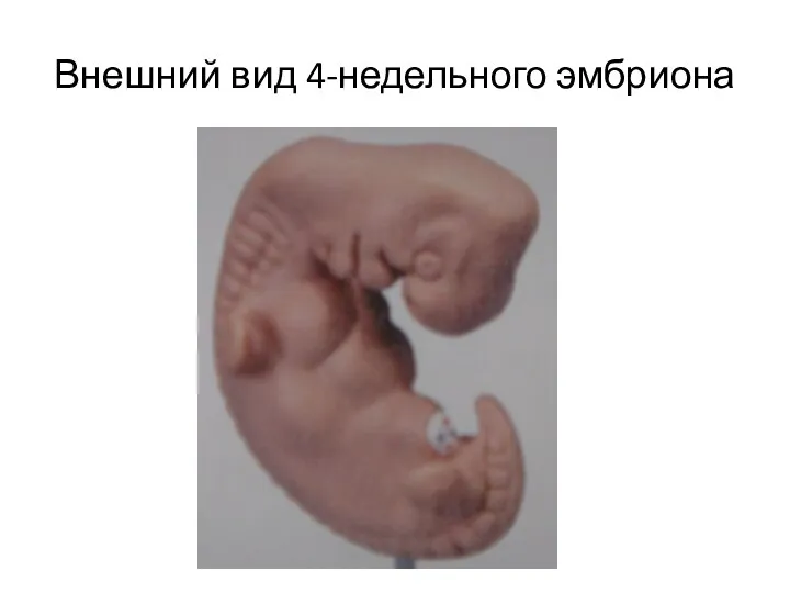 Внешний вид 4-недельного эмбриона