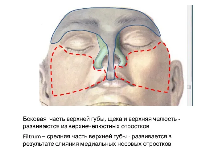 Боковая часть верхней губы, щека и верхняя челюсть - развиваются