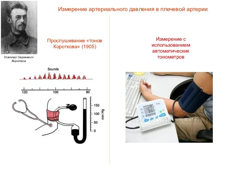 Измерение артериального давления в плечевой артерии Прослушивание «тонов Короткова» (1905)