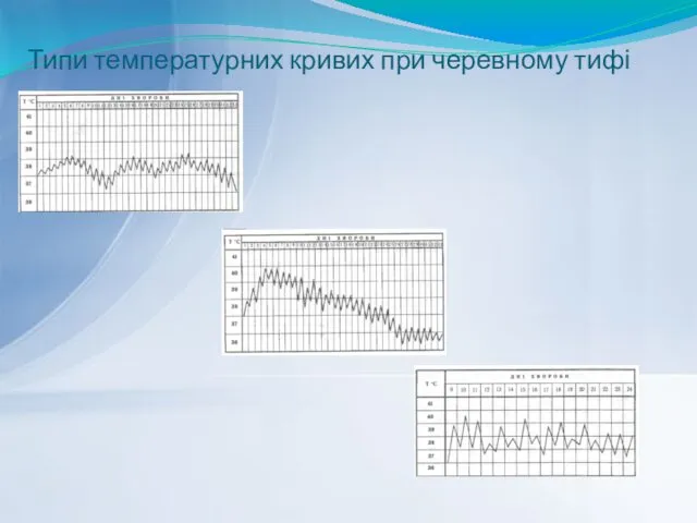 Типи температурних кривих при черевному тифі