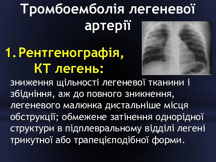 Тромбоемболія легеневої артерії Рентгенографія, КТ легень: зниження щільності легеневої тканини