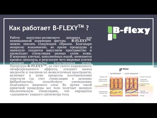 Как работает B-FLEXYTM ? Работу вакуумно-роликового аппарата для неинвазивной коррекции