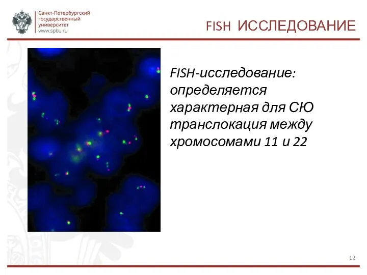 FISH ИССЛЕДОВАНИЕ FISH-исследование: определяется характерная для СЮ транслокация между хромосомами 11 и 22
