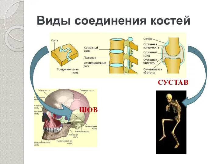 Виды соединения костей ШОВ СУСТАВ